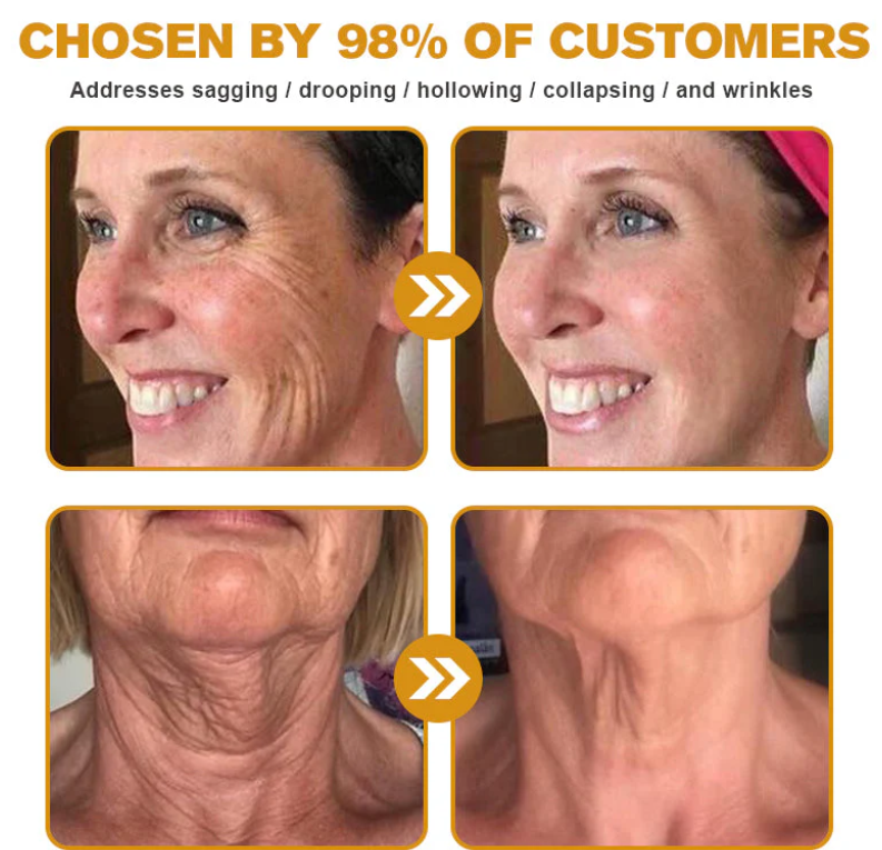 Buy 1 Get 1 Free | Bee Venom Anti-Ageing Wrinkle Cream | Skin Firming Body Cream