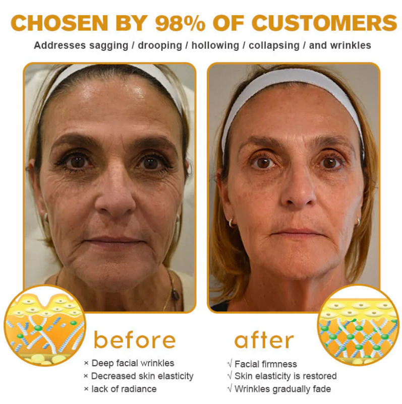 Buy 1 Get 1 Free | Bee Venom Anti-Ageing Wrinkle Cream | Skin Firming Body Cream